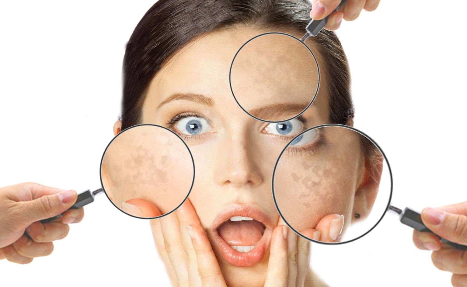 Macchie scure