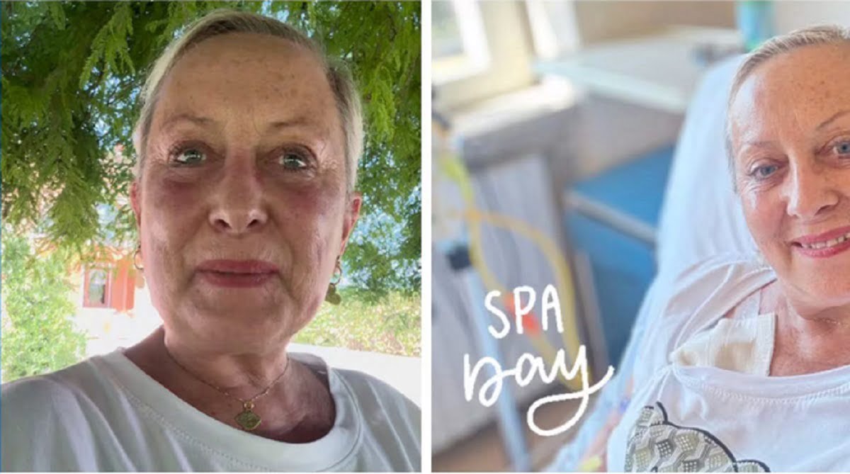Carolyn Smith sono a casa e continuo le mie cure contro i tumor 2024 07 19