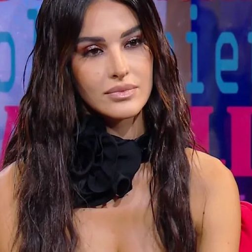 "Mi sono ustionata": Rosa Perrotta di Uomini e Donne racconta l’incidente e mostra la ferita