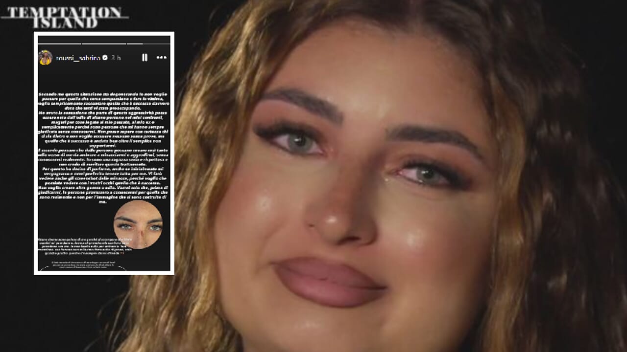 Sabrina Soussi di Temptation Island aggredita dagli hater: graffi sul volto